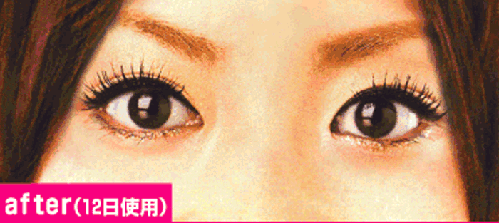 二重まぶたになって目が大きくなった事で、表情そのものがさわやかで明るく見えるようになりました。 (客観的にこの画像を見ても、『好意的に見てくれている』という印象が見受けられます)~リセであの人のハートをGETリセット 自分にあった二重まぶた本当に憧れのパッチリふたえになれた!!こんなに笑顔が魅力的に!~リセであの人のハートをGETリセット 自分にあった二重まぶたを自力で~自宅で簡単、自力で理想の二重ラインのリセ